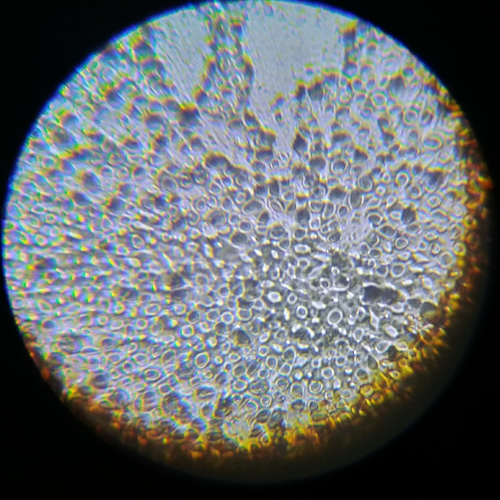 baker’s yeast